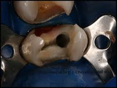 лечение болезней зубов
